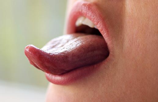 舌苔又黄又厚并非健康的舌头 舌苔黄厚的饮食疗方