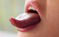 舌苔又黄又厚并非健康的舌头 舌苔黄厚的饮食疗方