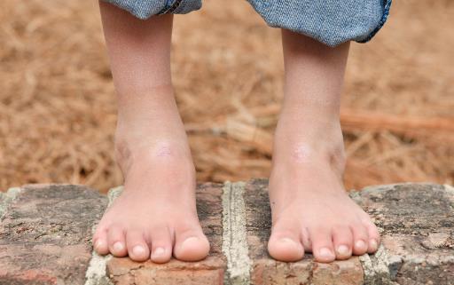 身体状况会在脚上显现 十大脚部问题是生病的征兆