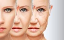 皮肤衰老颜龄大增的脸部细节 随着年龄增长皮脂降低