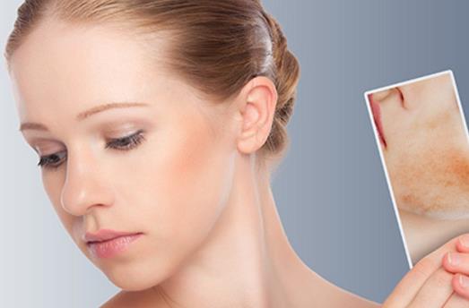 干性皮肤正确使用保湿面膜 干性皮肤日常注意事项