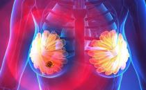 ​乳腺结节对女性危害大 乳腺结节形成的原因及预防