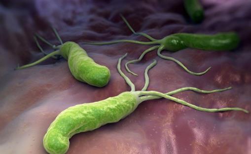 幽门螺杆菌的传染途径 幽门螺旋杆菌的治疗方法