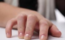 手指发麻可能与身体大病有关 尤其是上半身疾病