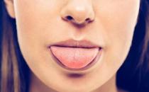 千古最绝的健脾祛湿方 适合每个人没有副作用