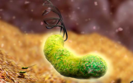 体内有幽门螺杆菌，身体往往有五个标志，占的越多，胃癌