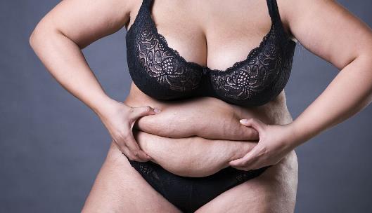 肥胖引起的并发症 肥胖是导致多种癌症的诱因之一