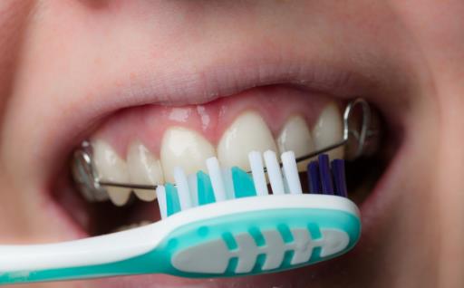 蛀牙疼痛难受 引发蛀牙的5个原因