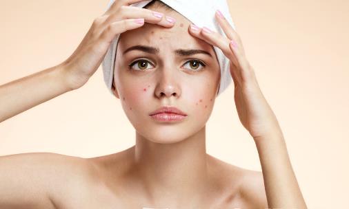 油性皮肤的特征鉴别 夏天油性皮肤护理小常识 