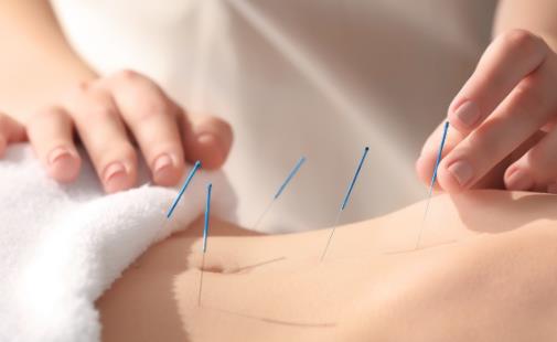 针灸和艾灸的区别 传统针灸的7种实用功效