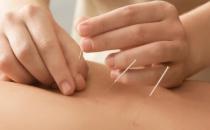 ​针灸和艾灸的区别 传统针灸的7种实用功效