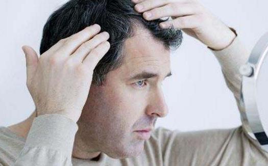 老年人掉头发的原因 预防老人的脱发护发食物