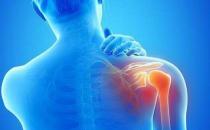 预防肩周炎从生活习惯做起 四个动作轻松帮你预防