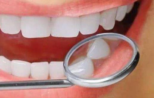 导致牙齿发黄的5大原因 应养成健康的护牙习惯