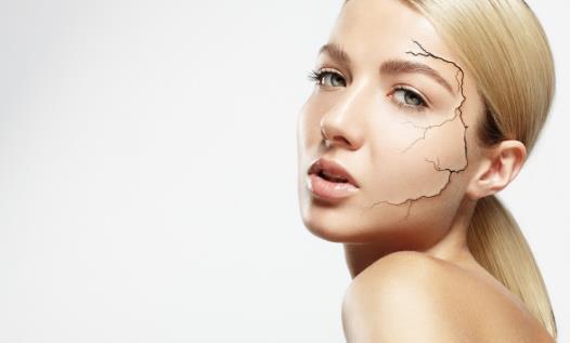敏感性皮肤的特点 改善敏感皮肤方法