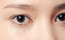 八种缓解黑眼圈的方法 令眼部呈现水润紧致状态