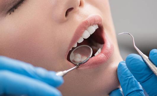 口腔健康受日常饮食很大干扰 能美白牙齿的10种食物