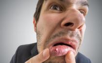 ​口腔溃疡的认识误区 能缓解口腔溃疡的水果