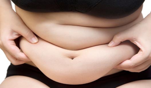 肥胖纹形成原因 8个方法帮你消除肥胖纹