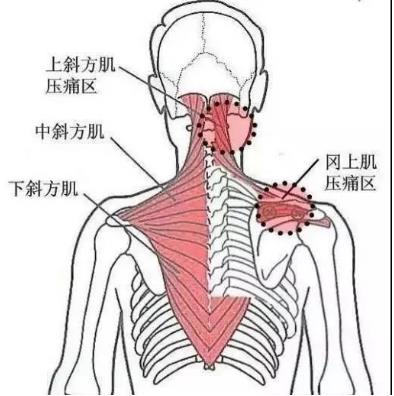 湛江崇爱康复医院科普如何防治肌筋膜炎 以真诚来服务患者