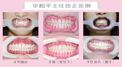 天津市中诺口腔医院 正畸主任李和平 讲解矫正与年龄无关