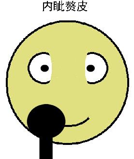 内眦赘皮怎么做效果好——北京彤美整形医院刘风卓