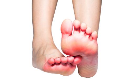 有脚气的人，经常用盐水泡脚就能消灭真菌吗？它没有这个