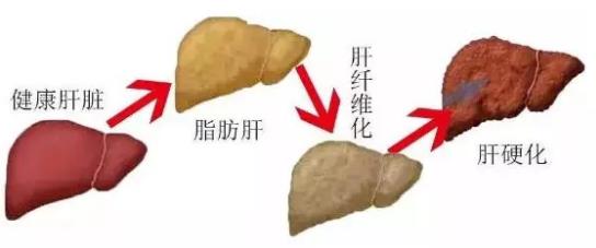 贵州治丙肝医院靠不靠谱 贵州中医肝病医院质量医疗的践行者