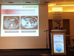 济南肿瘤医院选择广州复大肿瘤医院：冷冻需要新理念