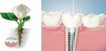 武汉做种植牙要多少钱,如何才能避免种植牙误区呢?