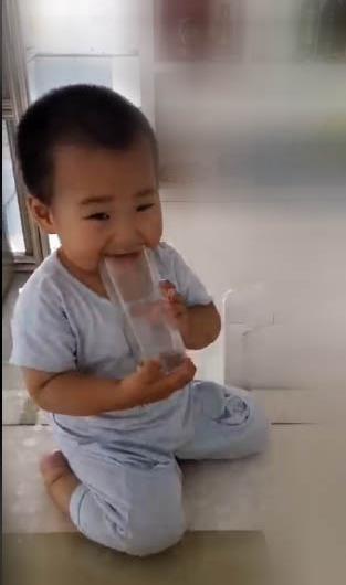 抓住治疗黄金期 别让这种先天性疾病影响孩子一生