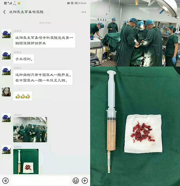 沈阳民生耳鼻喉医院看耳鼻喉口碑如何呢 诚信行医真心惠民