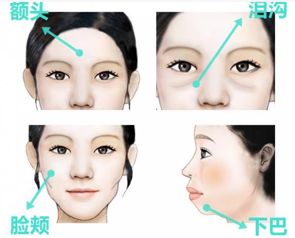 韦元强讲解：瘦子也适合做自体脂肪填充吗？