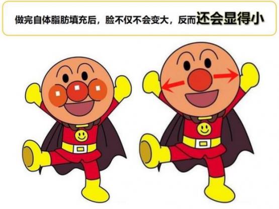 韦元强讲解：瘦子也适合做自体脂肪填充吗？