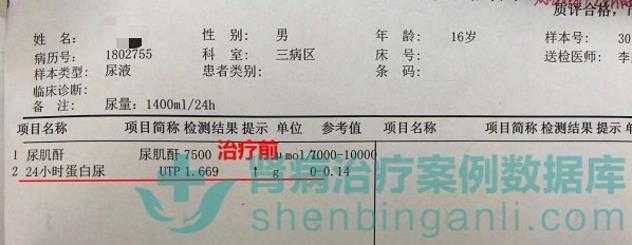 肾病综合征小患者青岛静康中医肾病医院治疗后病情改善