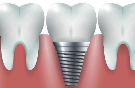 武汉德韩口腔：如何选择好的种植牙机构呢？