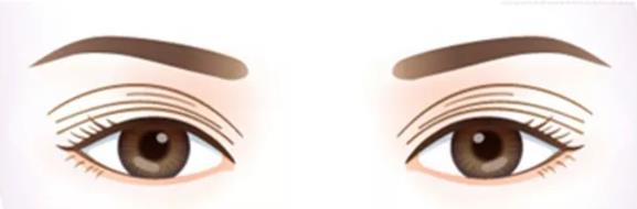 八大处整形赵延勇眼修复怎么样 用实力铸就业内口碑