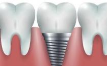 武汉德韩口腔：如何选择好的种植牙机构呢？