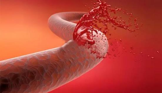 北京彤美整形医院桂行军科普:鼻整形术后饮食需要注意什么