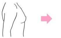 原来假体隆胸还可以这样解释！