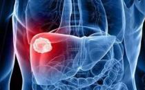 保护肝脏的9个关键点 防范“天敌”来护肝