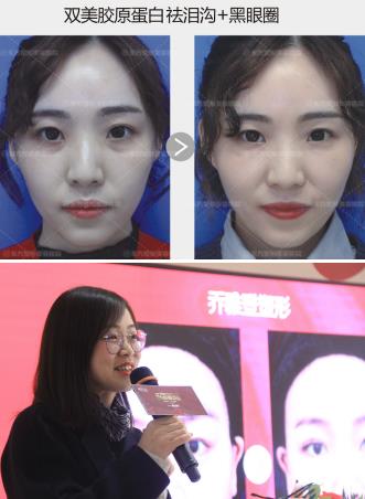 郑州东方整形医院乔妹VIP私享会圆满成功