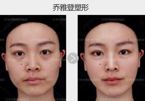 郑州东方整形医院乔妹VIP私享会圆满成功