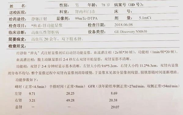 青岛静康医院案例：明明是重度肾衰,血肌酐却正常!化验单会说谎吗?