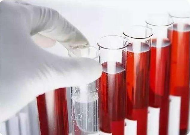 青岛静康医院案例：明明是重度肾衰,血肌酐却正常!化验单会说谎吗?