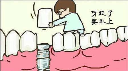 武汉德韩口腔揭秘！缺牙后什么时间去就诊最好？