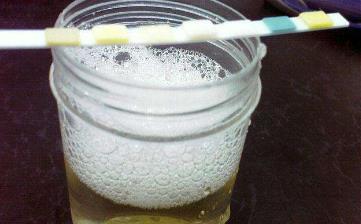 【尿泡沫】尿泡沫多是怎么回事_尿泡沫多散不干净的原因_尿泡沫到尿毒症 【尿泡沫】尿泡沫多是怎么回事_尿泡沫多散不干净的原因_尿泡沫到尿毒症