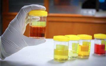 【尿液黄】尿液黄是什么原因_尿液发黄而浑浊是怎么回事_长期尿黄是什么病 【尿液黄】尿液黄是什么原因_尿液发黄而浑浊是怎么回事_长期尿黄是什么病