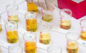 【尿液发黄】尿液发黄有异味是怎么回事_尿液发黄泡沫多_尿液特别黄的原因 【尿液发黄】尿液发黄有异味是怎么回事_尿液发黄泡沫多_尿液特别黄的原因