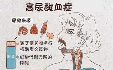 【血尿酸】血尿酸偏高的原因怎么办_血尿酸正常值_血尿酸是查什么项目 【血尿酸】血尿酸偏高的原因怎么办_血尿酸正常值_血尿酸是查什么项目